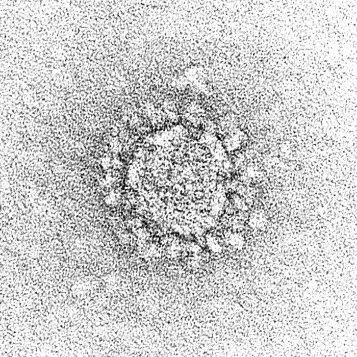 Electron microscope image of a virus shaped like a ball with protein protrusions around it.